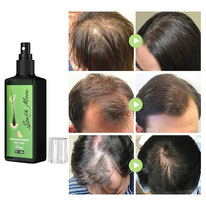 Haarwachstum Booster für Männer HaarBoost™