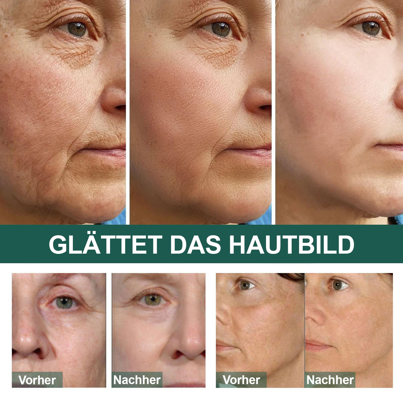 BioBoost™ - Fortschrittliches Anti-Falten-Serum